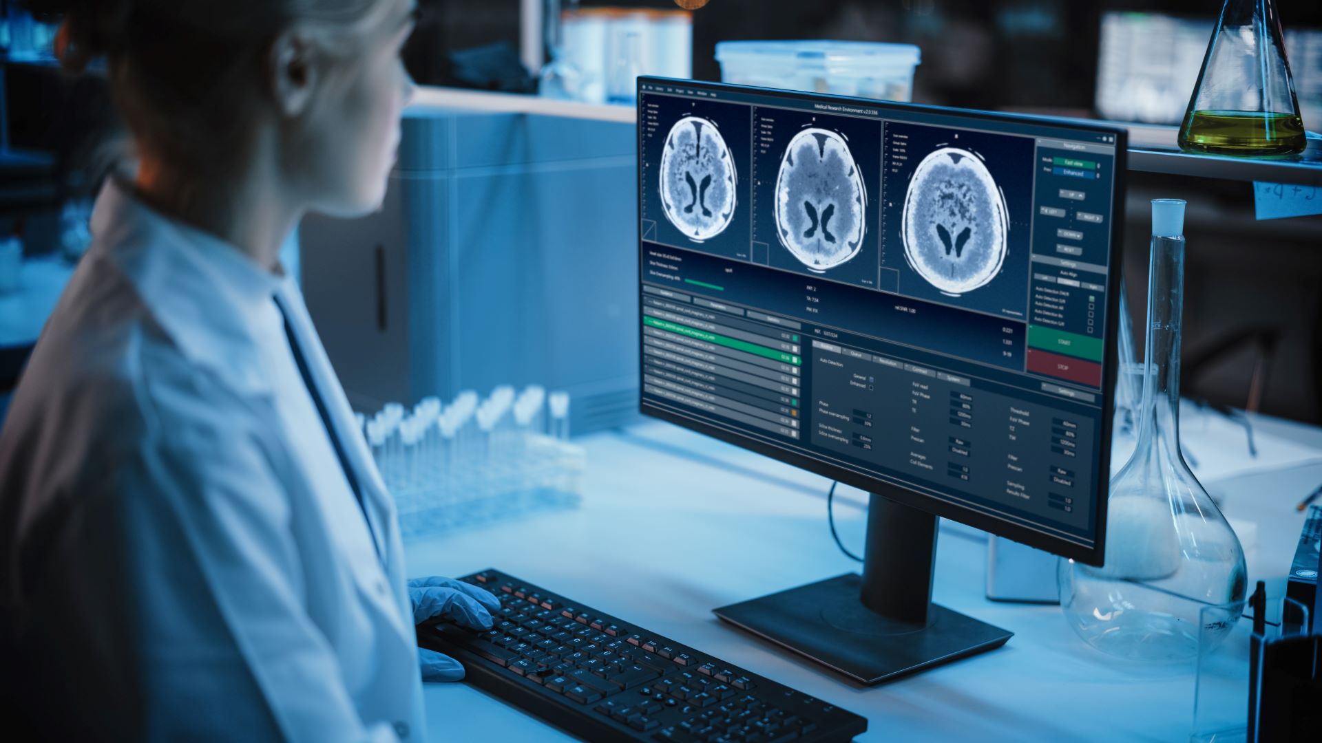 Medizinisches Forschungslabor: Porträt einer Wissenschaftlerin, die an einem Computer arbeitet, der MRT-Gehirnscans zeigt. Fortschrittliches wissenschaftliches Labor für Medizin, Krebsentwicklung. 